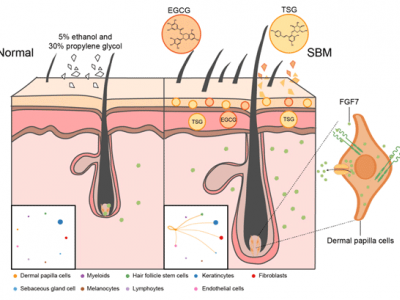 SIPIMO Essence Activates the FGF Pathway  in Dermal Papilla Cells to Promote Hair Regrowth